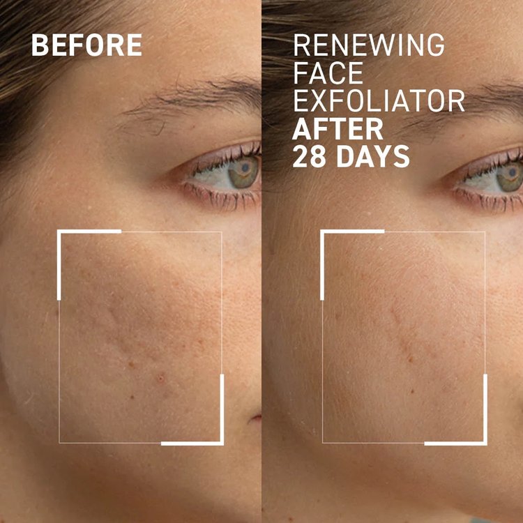 Exfoliante Facial Renovación Microdermabrasion 60 g - Dr. Brandt