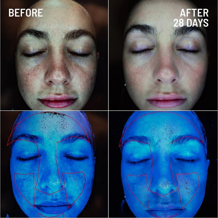 Exfoliante Facial Renovación Microdermabrasion 60 g - Dr. Brandt