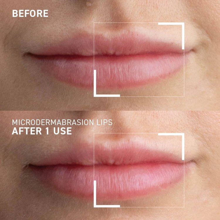 Exfoliante Labial Microdermabrasion 10 g - Dr. Brandt