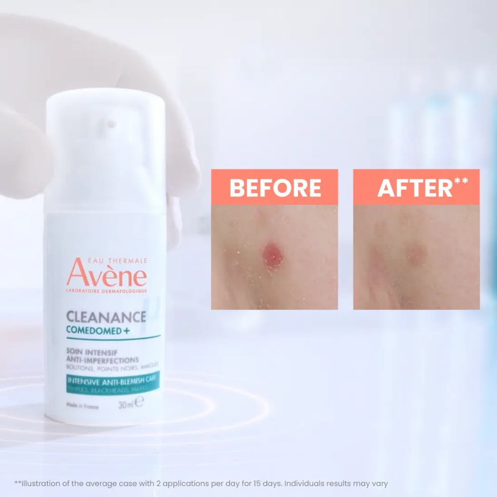Tratamiento Anti-Imperfecciones Cleanance Comedomed Concentrado 30 ml – Avène