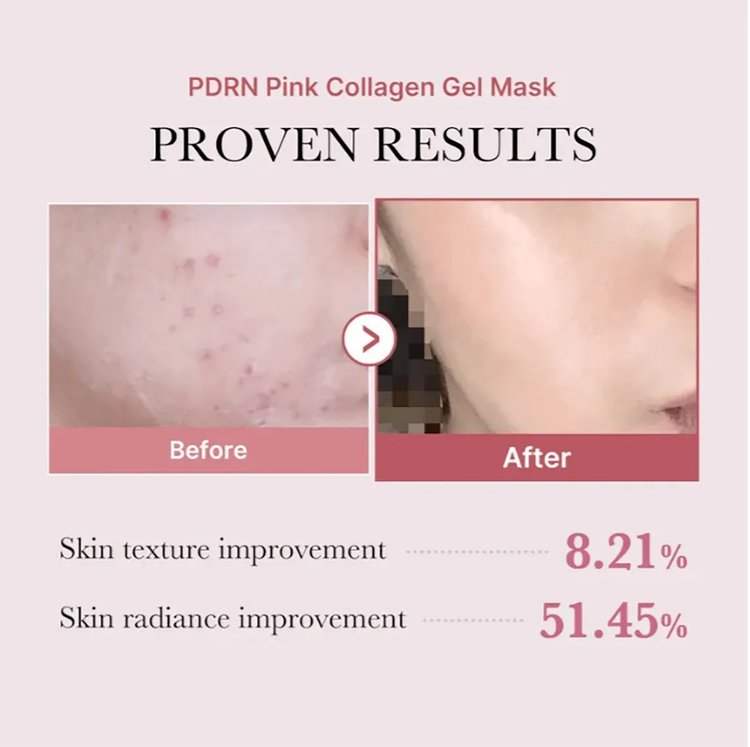 Mascarilla de Gel de Colágeno PDRN Pink EA - Medicube