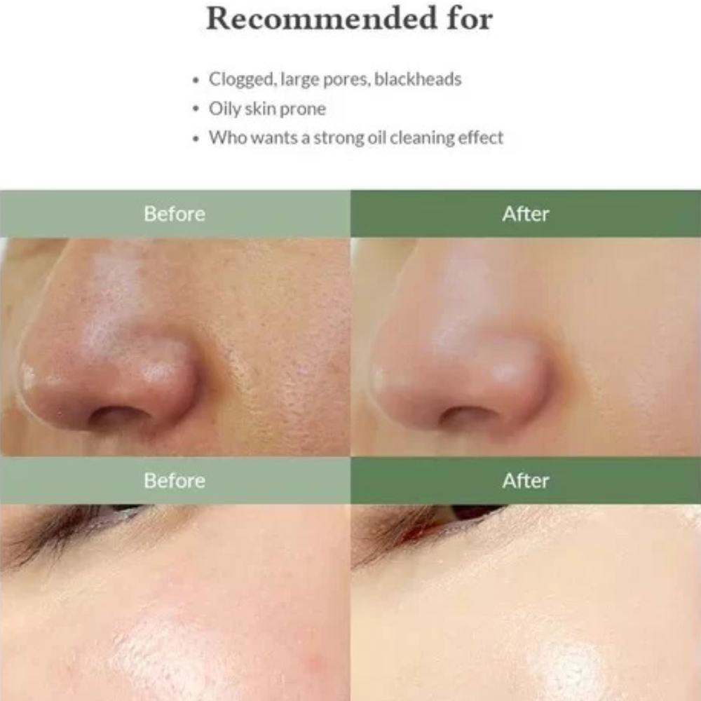 Limpiador Facial Premium Quick Step Sebum Cleanser- Dr. Althea